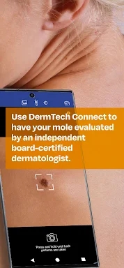 DermTech Connect screenshots