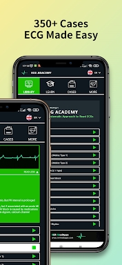 ECG Academy | EKG Cases 2022 screenshots