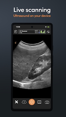 Clarius Ultrasound screenshots
