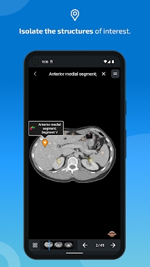 e-Anatomy screenshots