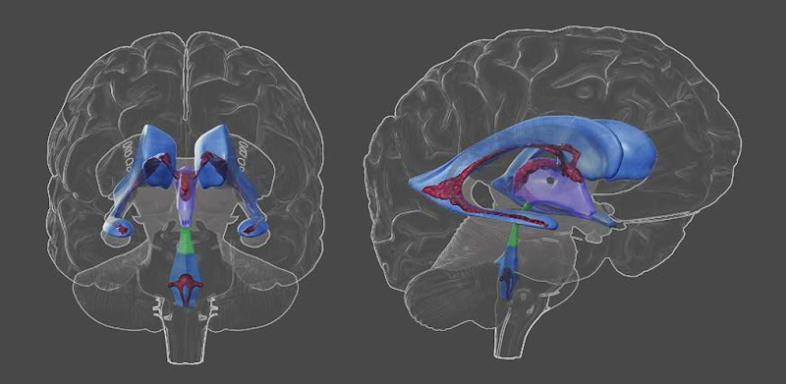 3D Brain screenshots