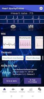 Heart dysrhythmias screenshots