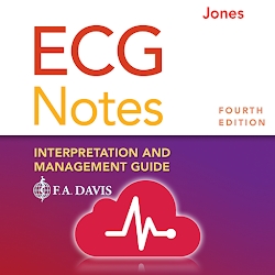 ECG Notes: Quick look-up ref.