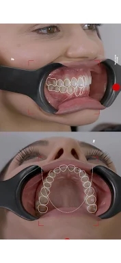Dental Shooting screenshots