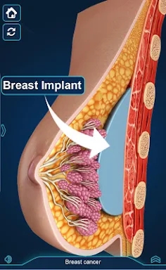 Breast Anatomy screenshots