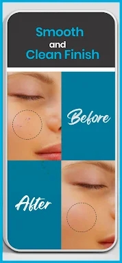 Pimple remover - Acne eraser screenshots