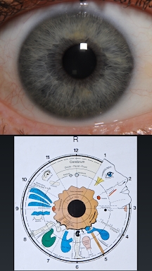 Eye Diagnosis screenshots