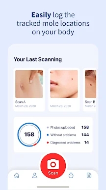 AI Dermatologist: Skin Scanner screenshots